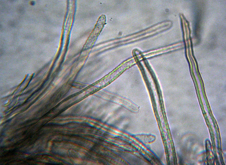 Forse � un ascomicete...(cfr. Lachnella sp.)